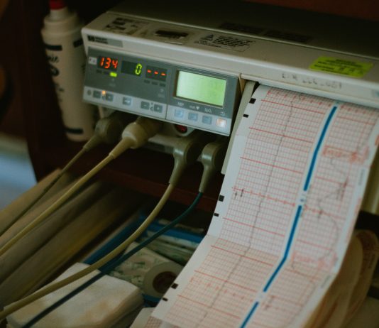 Why you may want to get a stress test